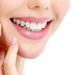 لصقات تبييض الأسنان... "أخطر" مما تتوقعون! 5 hollywood smile