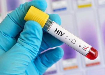 hiv 2