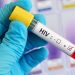 hiv 2