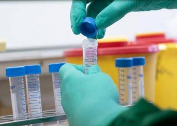 بلازما لرجل تعافى من فيروس “كورونا” تنقذ حياة المرضى