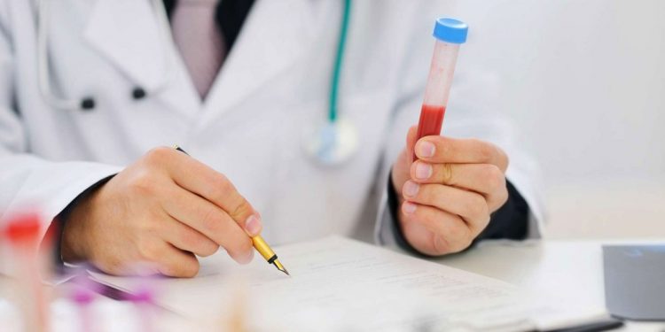 من لديهم مستويات أعلى من هذا الهرمون هم أكثر عرضة للوفاة بفيروس كورونا