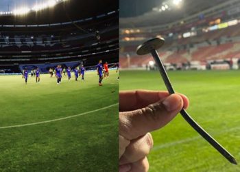 بالصور – بسبب مسمار… لاعب كرة قدم يتعرّض لإصابة مروّعة في ركبته