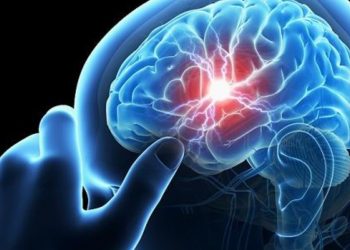 هكذا يمكن تقليل احتمالات الإصابة بسكتة دماغية