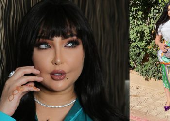 دنيا بطمة تنفي خضوعها لأي عملية تجميل