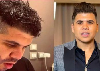 عمر كمال يغيب عن ارتباطاته بسبب عملية زراعة شعر في ذقنه