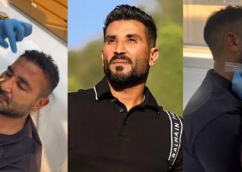 بالفيديو أحمد سعد يجري عملية تجميل جديدة لوجهه