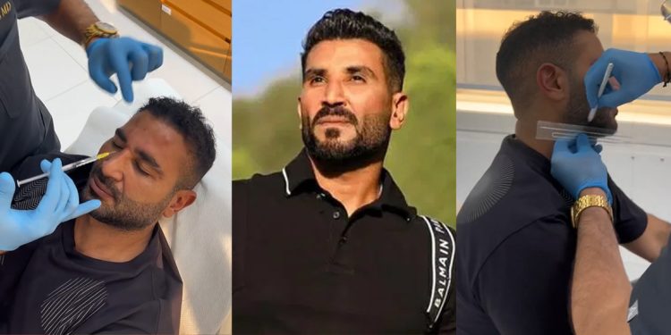 بالفيديو أحمد سعد يجري عملية تجميل جديدة لوجهه 1 بالفيديو أحمد سعد يجري عملية تجميل جديدة لوجهه