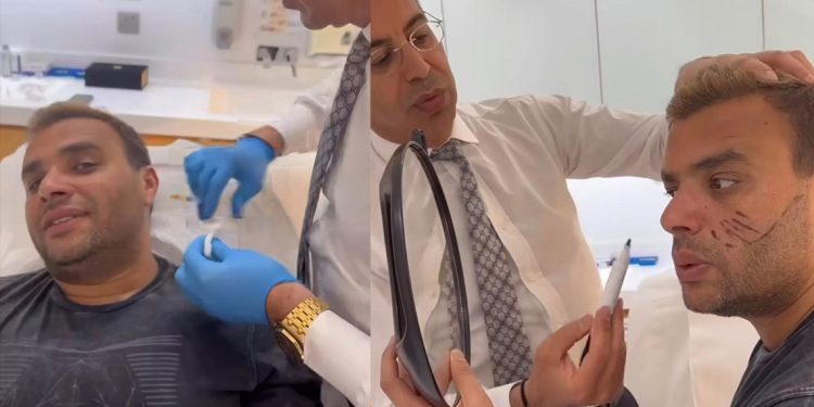 رامي صبري يجري تغييرات تجميلية بالبوتكوس في لبنان 1 رامي صبري يجري تغييرات تجميلية بالبوتكوس في لبنان