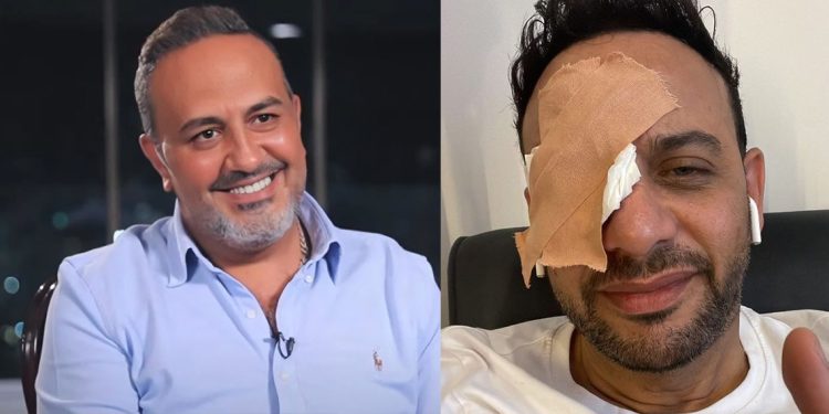 إصابة مصطفى قمر بضربة على عينه من خالد سرحان أثناء التصوير