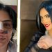 حورية فرغلي تجري عملية جديدة وأخيرة لترميم أنفها 14 حورية فرغلي تجري عملية جديدة وأخيرة لترميم أنفها